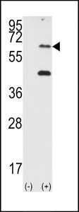 EIF2AK2 / PKR Antibody - Western blot of EIF2AK2 (arrow) using PRKR Antibody. 293 cell lysates (2 ug/lane) either nontransfected (Lane 1) or transiently transfected with the EIF2AK2 gene (Lane 2) (Origene Technologies).