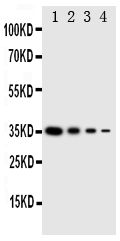 EIF2AK2 / PKR Antibody - Anti-PKR antibody, Western blottingRecombinant Protein Detection Source: E. coli derived -recombinant Human EIF2AK2, 35. 0KD (162aa tag+ M1-K154)Lane 1: Recombinant Human EIF2AK2 Protein 10ng Lane 2: Recombinant Human EIF2AK2 Protein 5ng Lane 3: Recombinant Human EIF2AK2 Protein 2. 5ng Lane 4: Recombinant Human EIF2AK2 Protein 1. 25ng