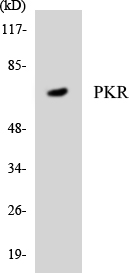 EIF2AK2 / PKR Antibody - Western blot analysis of the lysates from COLO205 cells using PKR antibody.