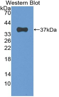 EIF2AK2 / PKR Antibody - Western blot of recombinant EIF2AK2 / PKR.