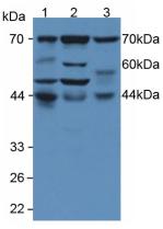 EIF2AK2 / PKR Antibody - Western Blot; Sample: Lane1: Human MCF7 Cells; Lane2: Human Hela Cells; Lane3: Human Jurkat Cells.