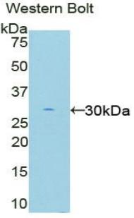 EIF2AK2 / PKR Antibody - Western blot of recombinant EIF2AK2 / PKR.  This image was taken for the unconjugated form of this product. Other forms have not been tested.