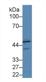 EIF2AK2 / PKR Antibody - Western Blot; Sample: Human Hela cell lysate; Primary Ab: 2µg/ml Rabbit Anti-Rat PKR Antibody Second Ab: 0.2µg/mL HRP-Linked Caprine Anti-Rabbit IgG Polyclonal Antibody
