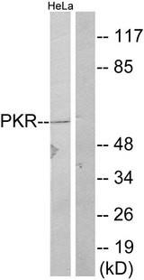 EIF2AK2 / PKR Antibody - Western blot analysis of lysates from HeLa, using PKR Antibody. The lane on the right is blocked with the synthesized peptide.