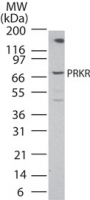 EIF2AK2 / PKR Antibody - Western blot of PRKR in human Daudi cell lysate using antibody at1 ug/ml.