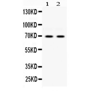 EIF2AK2 / PKR Antibody - PKR antibody Western blot. All lanes: Anti PKR at 0.5 ug/ml. Lane 1: HELA Whole Cell Lysate at 40 ug. Lane 2: A549 Whole Cell Lysate at 40 ug. Predicted band size: 69 kD. Observed band size: 69 kD.