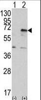 EIF2AK2 / PKR Antibody - Western blot of EIF2AK2 (arrow) using PRKR Antibody. 293 cell lysates (2 ug/lane) either nontransfected (Lane 1) or transiently transfected with the EIF2AK2 gene (Lane 2) (Origene Technologies).