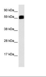 EIF2AK2 / PKR Antibody - Fetal Stomach Lysate.  This image was taken for the unconjugated form of this product. Other forms have not been tested.