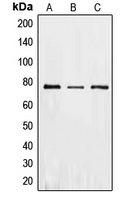 EIF2AK2 / PKR Antibody - Western blot analysis of PKR expression in HeLa (A); MCF7 (B); Caco2 (C) whole cell lysates.