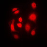 EIF2AK2 / PKR Antibody - Immunofluorescent analysis of PKR staining in MCF7 cells. Formalin-fixed cells were permeabilized with 0.1% Triton X-100 in TBS for 5-10 minutes and blocked with 3% BSA-PBS for 30 minutes at room temperature. Cells were probed with the primary antibody in 3% BSA-PBS and incubated overnight at 4 C in a humidified chamber. Cells were washed with PBST and incubated with a DyLight 594-conjugated secondary antibody (red) in PBS at room temperature in the dark. DAPI was used to stain the cell nuclei (blue).