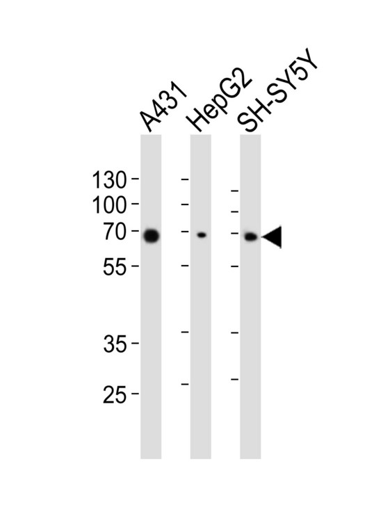 EIF2AK2 / PKR Antibody - Western blot of lysates from A431, HepG2, SH-SY5Y cell line (from left to right), using EIF2AK2 antibody diluted at 1:1000 at each lane. A goat anti-mouse IgG H&L (HRP) at 1:3000 dilution was used as the secondary antibody. Lysates at 20 ug per lane.