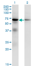 EIF2AK2 / PKR Antibody - Western blot of EIF2AK2 expression in transfected 293T cell line by EIF2AK2 monoclonal antibody (M01), clone 1B9.