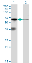 EIF2AK2 / PKR Antibody - Western blot of EIF2AK2 expression in transfected 293T cell line by EIF2AK2 monoclonal antibody (M02), clone 1D11.