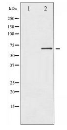 EIF2AK2 / PKR Antibody - Western blot of PKR expression in Starvation treated K562 whole cell lysates,The lane on the left is treated with the antigen-specific peptide.