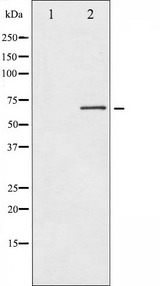EIF2AK2 / PKR Antibody - Western blot analysis of PKR expression in Starvation treated K562 whole cells lysates. The lane on the left is treated with the antigen-specific peptide.