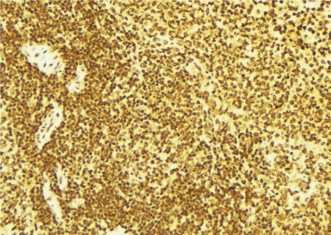 EIF2AK2 / PKR Antibody - 1:100 staining mouse spleen tissue by IHC-P. The sample was formaldehyde fixed and a heat mediated antigen retrieval step in citrate buffer was performed. The sample was then blocked and incubated with the antibody for 1.5 hours at 22°C. An HRP conjugated goat anti-rabbit antibody was used as the secondary.