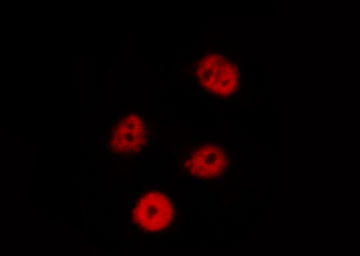 EIF2AK2 / PKR Antibody - Staining HeLa cells by IF/ICC. The samples were fixed with PFA and permeabilized in 0.1% Triton X-100, then blocked in 10% serum for 45 min at 25°C. The primary antibody was diluted at 1:200 and incubated with the sample for 1 hour at 37°C. An Alexa Fluor 594 conjugated goat anti-rabbit IgG (H+L) Ab, diluted at 1/600, was used as the secondary antibody.