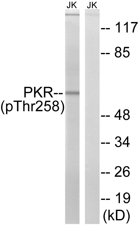 EIF2AK2 / PKR Antibody - Western blot analysis of lysates from Jurkat cells treated with starved 24h, using PKR (Phospho-Thr258) Antibody. The lane on the right is blocked with the phospho peptide.