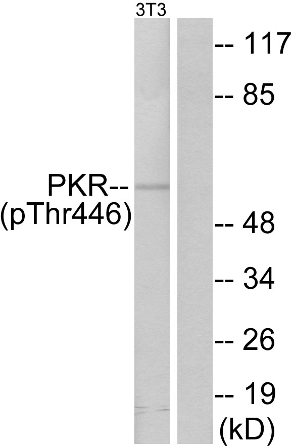EIF2AK2 / PKR Antibody - Western blot analysis of lysates from NIH/3T3 cells treated with IFN 2500U/ml 30', using PKR (Phospho-Thr446) Antibody. The lane on the right is blocked with the phospho peptide.