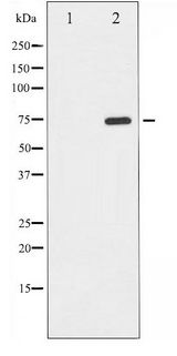 EIF2AK2 / PKR Antibody - Western blot of PKR phosphorylation expression in Starvation treated K562 whole cell lysates,The lane on the left is treated with the antigen-specific peptide.