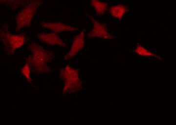 EIF2AK2 / PKR Antibody - Staining HeLa cells by IF/ICC. The samples were fixed with PFA and permeabilized in 0.1% Triton X-100, then blocked in 10% serum for 45 min at 25°C. The primary antibody was diluted at 1:200 and incubated with the sample for 1 hour at 37°C. An Alexa Fluor 594 conjugated goat anti-rabbit IgG (H+L) Ab, diluted at 1/600, was used as the secondary antibody.