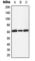 EIF2AK2 / PKR Antibody - Western blot analysis of PKR (pT451) expression in HeLa PMA-treated (A); Raw264.7 H2O2-treated (B); NIH3T3 LPS-treated (C) whole cell lysates.