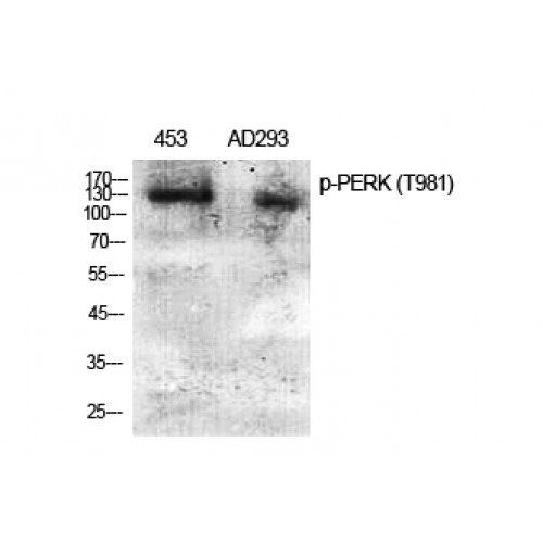 EIF2AK3 / PERK Antibody - Western blot of Phospho-PERK (T981) antibody