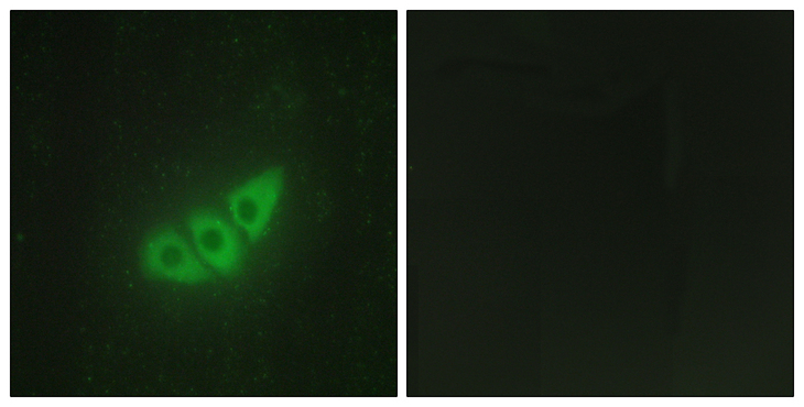 EIF2AK3 / PERK Antibody - Immunofluorescence analysis of HepG2 cells, using E2AK3 Antibody. The picture on the right is blocked with the synthesized peptide.