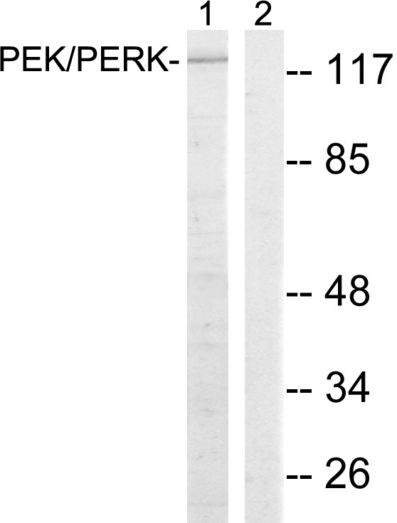 EIF2AK3 / PERK Antibody - Western blot analysis of lysates from MCF-7 cells, using PEK/PERK Antibody. The lane on the right is blocked with the synthesized peptide.