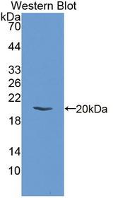 EIF2AK3 / PERK Antibody - Western blot of EIF2AK3 / PERK antibody.