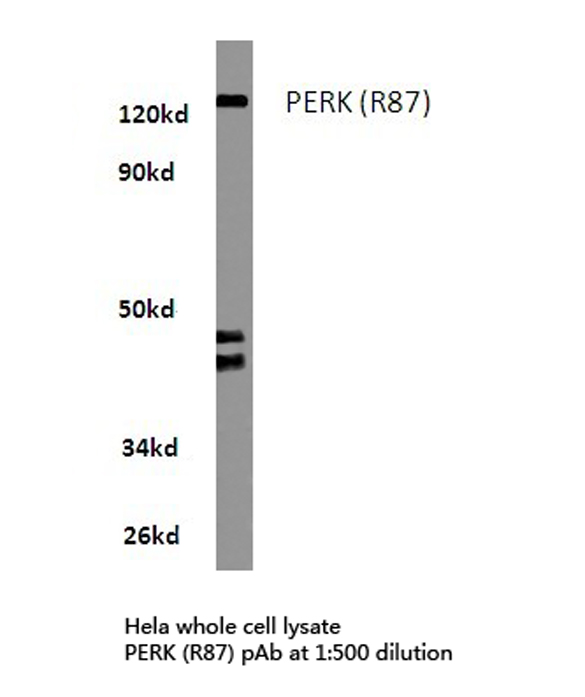 EIF2AK3 / PERK Antibody - Western blot of PERK (R87) pAb in extracts from HeLa cells.