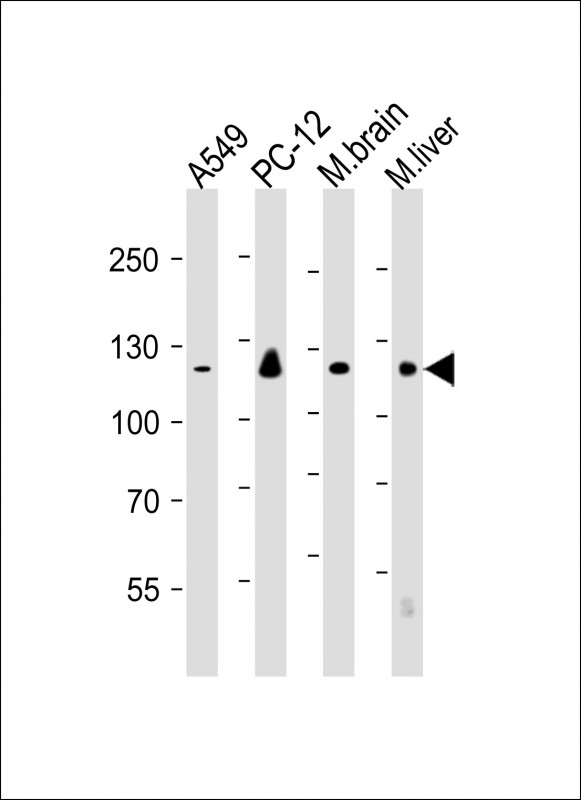 EIF2AK3 / PERK Antibody - All lanes: Anti-EIF2AK3 Antibody at 1:250-1:1000 dilution Lane 1: A549 whole cell lysate Lane 2: PC-12 whole cell lysate Lane 3: mouse brain lysate Lane 4: mouse liver lysate Lysates/proteins at 20 µg per lane. Secondary Goat Anti-mouse IgG, (H+L), Peroxidase conjugated at 1/10000 dilution. Predicted band size: 125 kDa Blocking/Dilution buffer: 5% NFDM/TBST.