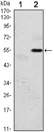 EIF2AK3 / PERK Antibody - PERK Antibody in Western Blot (WB)