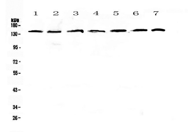 EIF2AK3 / PERK Antibody - Western blot - Anti-PERK Picoband antibody