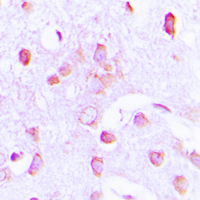 EIF2AK3 / PERK Antibody - Immunohistochemical analysis of PERK staining in human brain formalin fixed paraffin embedded tissue section. The section was pre-treated using heat mediated antigen retrieval with sodium citrate buffer (pH 6.0). The section was then incubated with the antibody at room temperature and detected using an HRP conjugated compact polymer system. DAB was used as the chromogen. The section was then counterstained with hematoxylin and mounted with DPX.