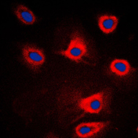 EIF2AK3 / PERK Antibody - Immunofluorescent analysis of PERK staining in HeLa cells. Formalin-fixed cells were permeabilized with 0.1% Triton X-100 in TBS for 5-10 minutes and blocked with 3% BSA-PBS for 30 minutes at room temperature. Cells were probed with the primary antibody in 3% BSA-PBS and incubated overnight at 4 C in a humidified chamber. Cells were washed with PBST and incubated with a DyLight 594-conjugated secondary antibody (red) in PBS at room temperature in the dark. DAPI was used to stain the cell nuclei (blue).