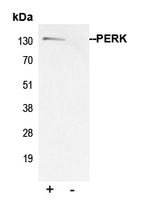 EIF2AK3 / PERK Antibody - Immunoprecipitation of PERK from 0.5mg HeLa whole cell extract lysate using 5ug of Anti-PERK Antibody and 50ul of protein G magnetic beads (+). No antibody was added to the control (-). The antibody was incubated under agitation with Protein G beads for 10min HeLa whole cell extract lysate diluted in RIPA buffer was added to each sample and incubated for a further 10min under agitation. Proteins were eluted by addition of 40ul SDS loading buffer and incubated for 10min at 70 C; 10ul of each sample was separated on a SDS PAGE gel transferred to a nitrocellulose membrane blocked with 5% BSA and probed with Anti-PERK Antibody.