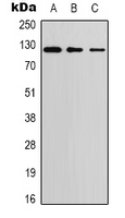 EIF2AK3 / PERK Antibody - Western blot analysis of PERK expression in A549 (A); MCF7 (B); 3T3 (C) whole cell lysates.