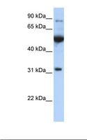 EIF2B1 Antibody - Jurkat cell lysate. Antibody concentration: 1.0 ug/ml. Gel concentration: 12%.  This image was taken for the unconjugated form of this product. Other forms have not been tested.
