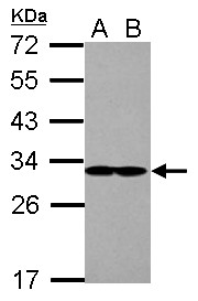 EIF2B1 Antibody - Sample (30 ug of whole cell lysate) A: A431 B: Jurkat 12% SDS PAGE EIF2B1 / EIF2B antibody diluted at 1:10000