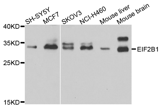 EIF2B1 Antibody - Western blot analysis of extracts of various cell lines.