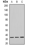 EIF2B1 Antibody - Western blot analysis of eIF2B1 expression in SHSY5Y (A); MCF7 (B); mouse liver (C); mouse brain (D) whole cell lysates.