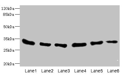 EIF2B1 Antibody - Western blot All Lanes: EIF2B1 antibody at 5.14ug/ml Lane 1: MCF7 whole cell lysate Lane 2: K562 whole cell lysate Lane 3: Mouse liver tissue Lane 4: Mouse brain tissue Lane 5: Jurkat whole cell lysate Lane 6: A431 whole cell lysate Secondary Goat polyclonal to Rabbit IgG at 1/10000 dilution Predicted band size: 34,25 kDa Observed band size: 34 kDa