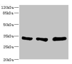 EIF2B1 Antibody - Western blot All lanes: EIF2B1 antibody at 5.14µg/ml Lane 1: K562 whole cell lysate Lane 2: Mouse brain tissue Lane 3: Jurkat whole cell lysate Secondary Goat polyclonal to rabbit IgG at 1/10000 dilution Predicted band size: 34, 25 kDa Observed band size: 34 kDa