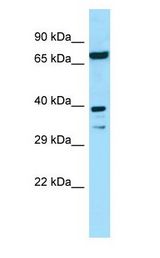 EIF2B2 Antibody - EIF2B2 / EIF2B antibody Western Blot of 293T.  This image was taken for the unconjugated form of this product. Other forms have not been tested.