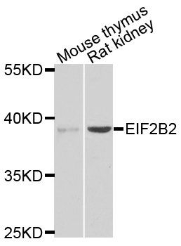 EIF2B2 Antibody - Western blot analysis of extracts of various tissues.