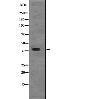 EIF2B2 Antibody - Western blot analysis of EIF2B2 expression in A431 whole cells lysate. The lane on the left is treated with the antigen-specific peptide.