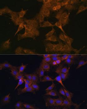 EIF2B2 Antibody - Immunofluorescence analysis of C6 cells using EIF2B2 Polyclonal Antibody at dilution of 1:100.Blue: DAPI for nuclear staining.