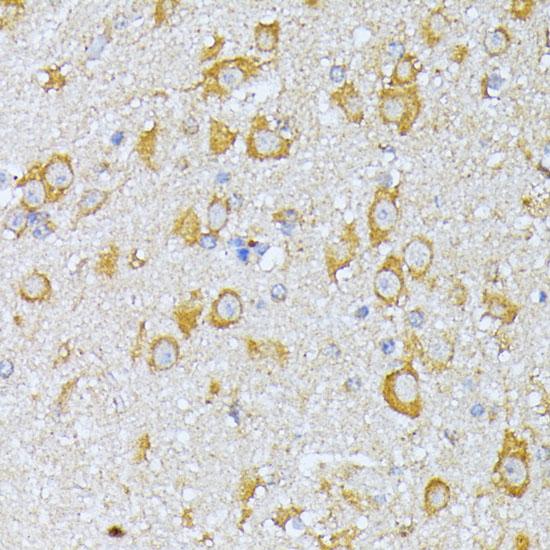 EIF2B2 Antibody - Immunohistochemistry of paraffin-embedded Mouse brain using EIF2B2 Polyclonal Antibody at dilution of 1:100 (40x lens).