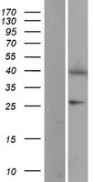 EIF2B2 Protein - Western validation with an anti-DDK antibody * L: Control HEK293 lysate R: Over-expression lysate
